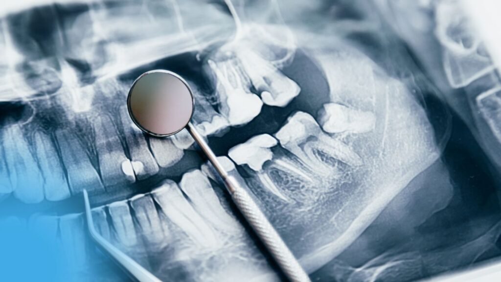 BIOMECHANISCHE ASPEKTE DER IMPLANTATPROTHESE