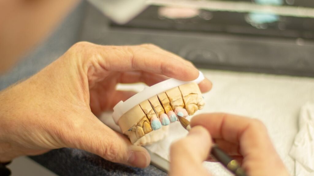 GINGIVEKTOMIE – GINGIVOPLASTIK